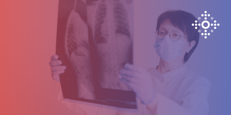 Управління небажаними явищами під час лікування туберкульозу